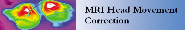 MRI Head Movement 
Correction